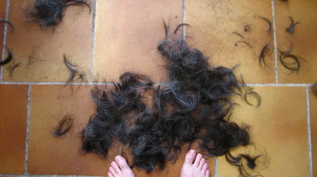 Почему стригут волосы после тифа