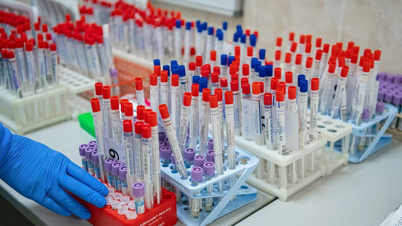 За сутки в России выявлено 5849 случаев заражения коронавирусом