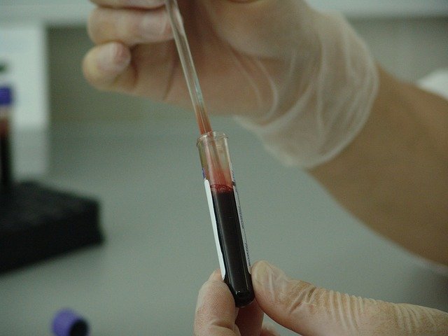 В Севастополе в рамках акции можно бесплатно сдать экспресс-тест на ВИЧ