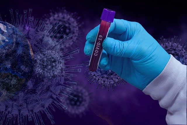 За сутки в Крыму выявили более 700 зараженных коронавирусом